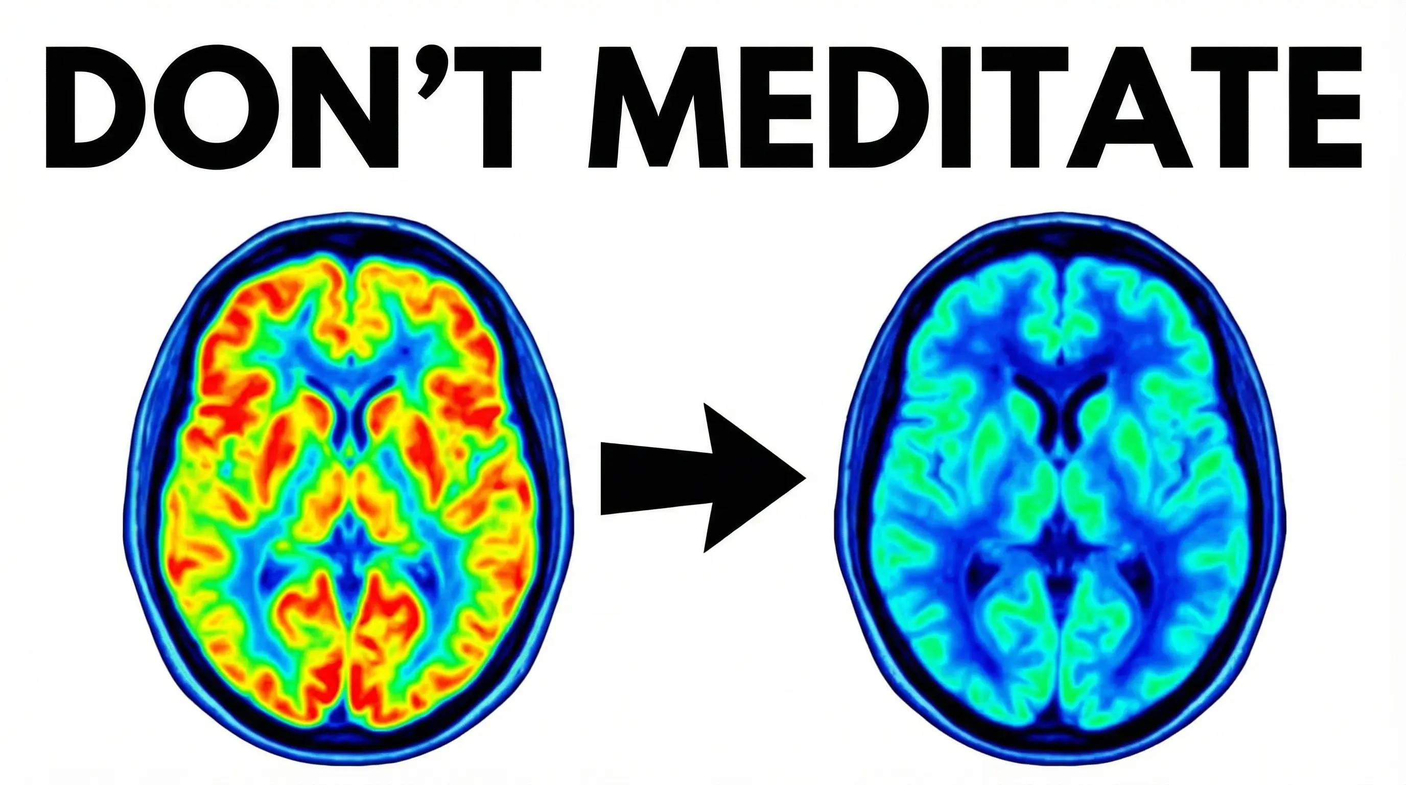 Meditation is Killing Your Brain Thumbnail